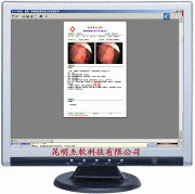 胃肠镜影像系统工作站