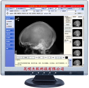 X光影像系统工作站