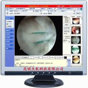 关节镜影像系统工作站