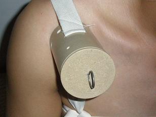 家用灸疗导入器艾灸肩周炎