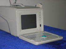 便携式超声诊断仪