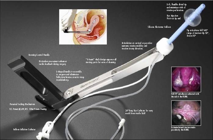 美国Coopersurgical 举宫器