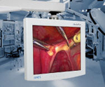 手术室专用高清监视器