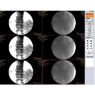 影像工作站软件