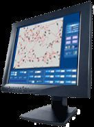 精子质量分析系统