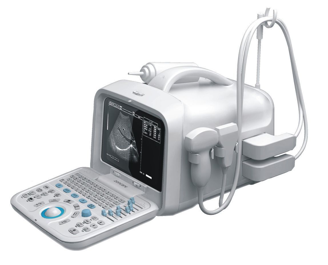 全数字超声诊断系统