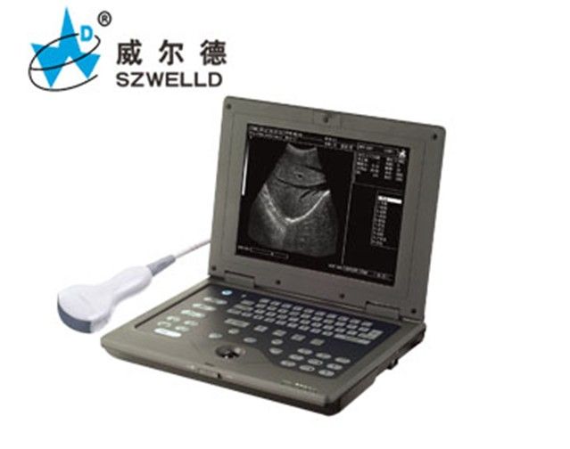 笔记本式b超