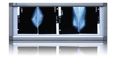 乳腺专用观片灯