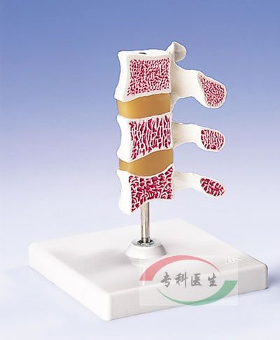 骨质疏松症模型