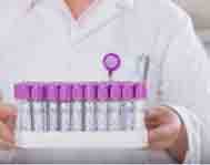 采血管辐照灭菌