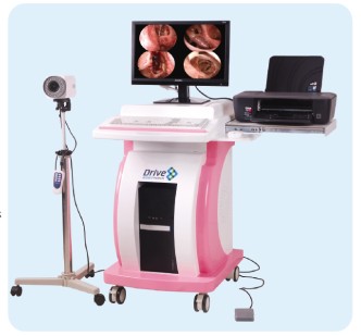 数码电子阴道镜