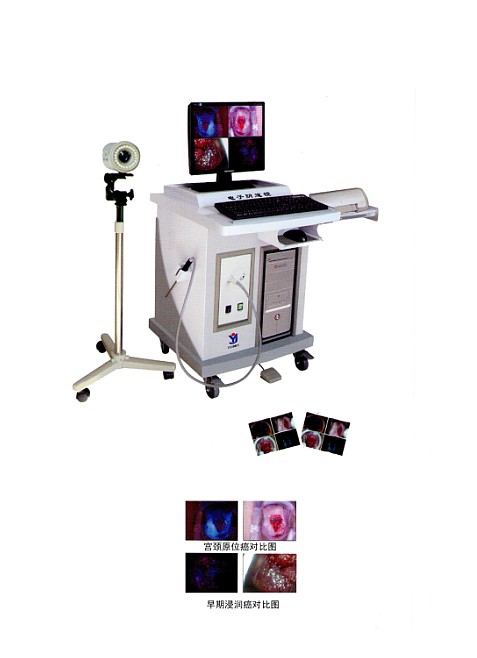 荧光数码电子阴道镜