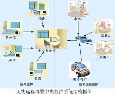 母婴监护仪