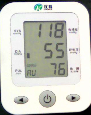 全自动臂式电子血压计