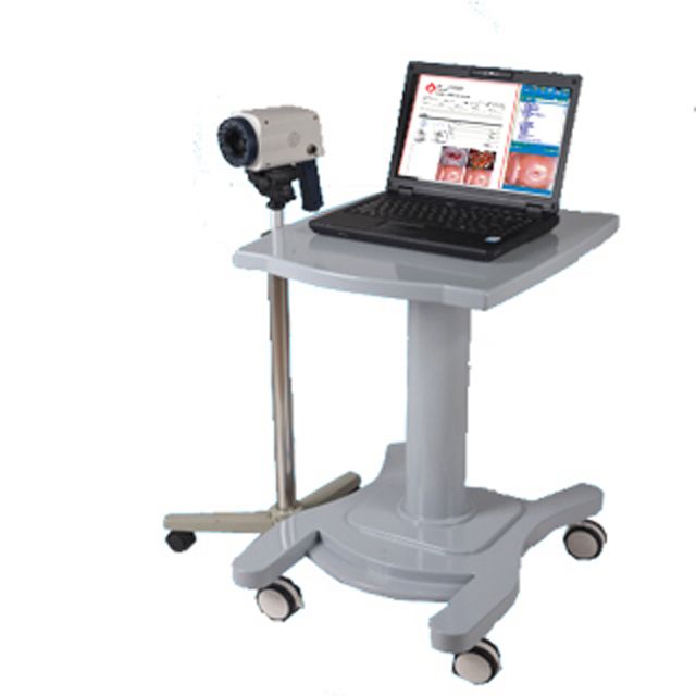 便携式电子阴道镜