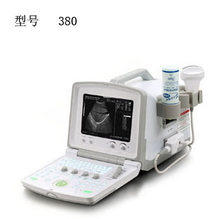 便携式B超诊断仪