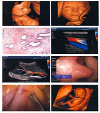 JZ新型B超PET 医用胶片