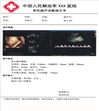 蓝光高清医用胶片