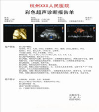 B超激光彩色医用胶片