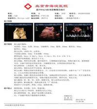 激光彩色打印机配套PET医用胶片