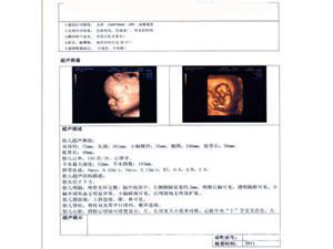 X光医用胶片,B超胶片