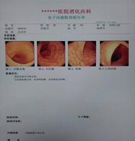 肠镜、气管镜专用JZ彩色打印医用胶片