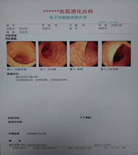 超声放射B超高清医用胶片
