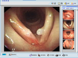 耳鼻喉镜医学影像系统