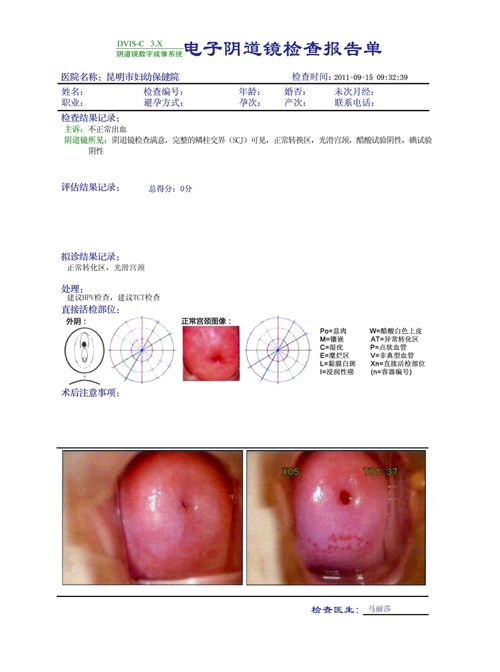 MPET新型B超胶片