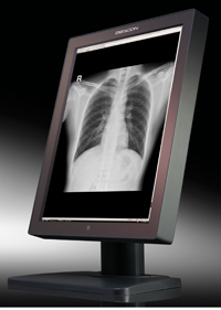 医用灰阶显示器