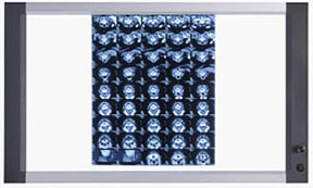 双联LED医用观片灯