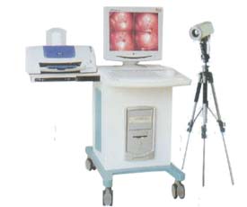 数码电子阴道镜