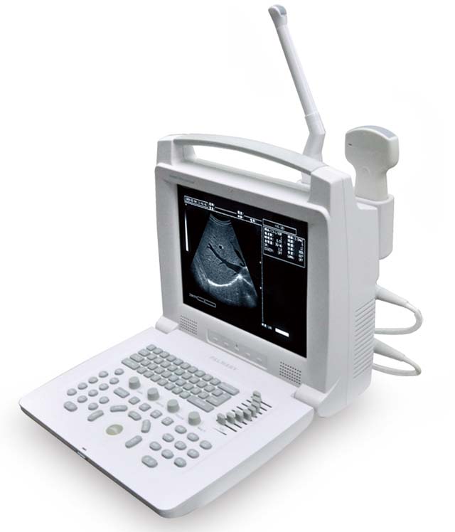 PL-3018I 全数字便携式B超