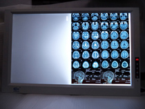 LED双联调光型观片灯