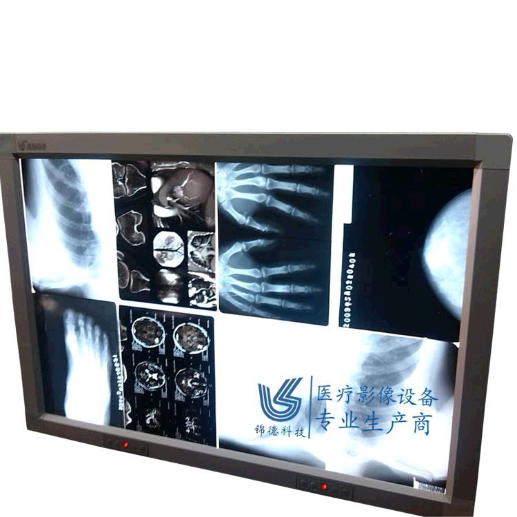 医用乳腺观片灯