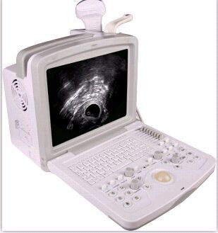 阴道超声实时监视系统
