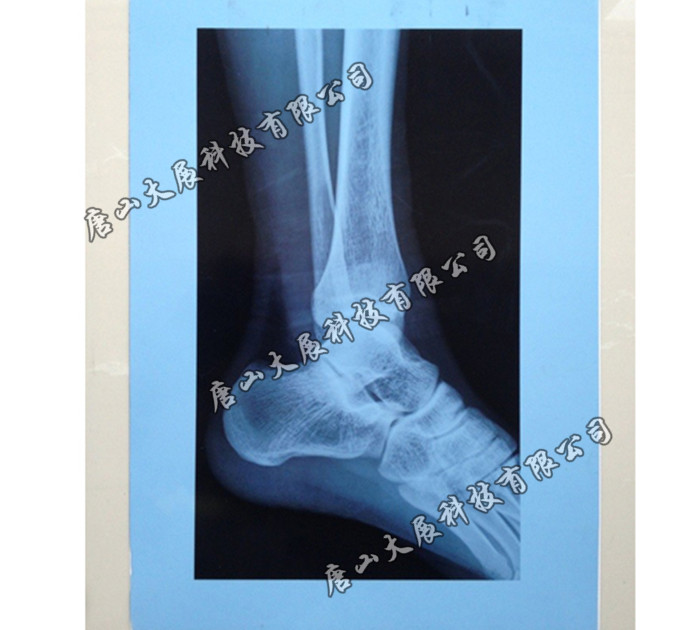 蓝基喷墨打印胶片