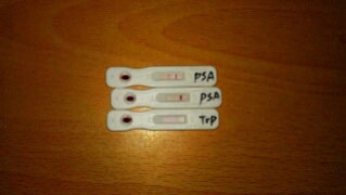 AFP (α胎蛋白)检验试剂