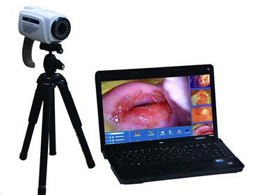 数码电子阴道镜(笔记本便携式)