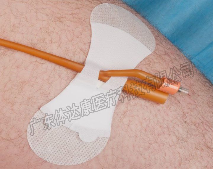 导管固定贴,导管固定装置