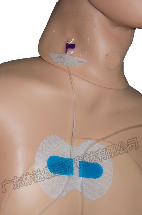 导管固定贴,导管固定装置