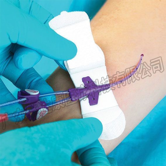 导管固定贴,导管固定装置