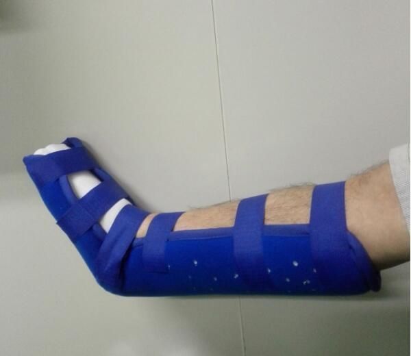 医用外固定夹板