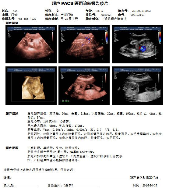 医用胶片-白基胶片