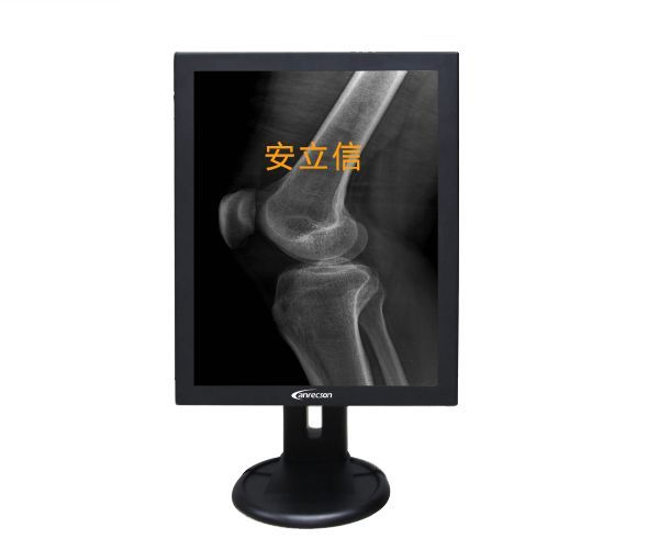 PACS影像系统专用灰阶竖屏显示器/灰阶影像诊断显示器/灰阶屏兆