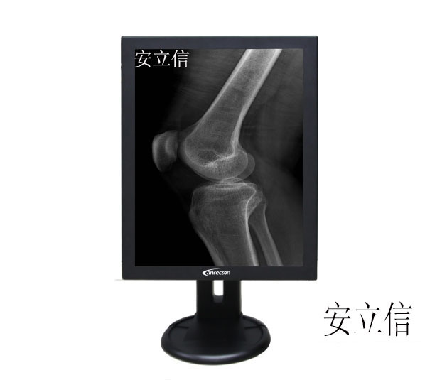 适用于DR诊断系统/大型多排CT/MRI核磁共振设备专用3M灰阶显示器