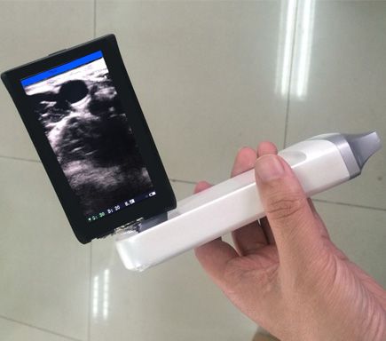 XProbe系列带屏无线探头式B超掌上超声迷你超声