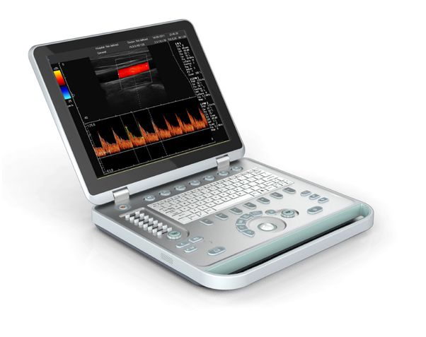 C5Plus型彩色多普勒超声诊断系统笔记本超声便携式彩超