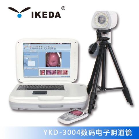 YKD-3004数码电子阴道镜