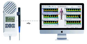 糖尿病足箱,周围神经检测仪